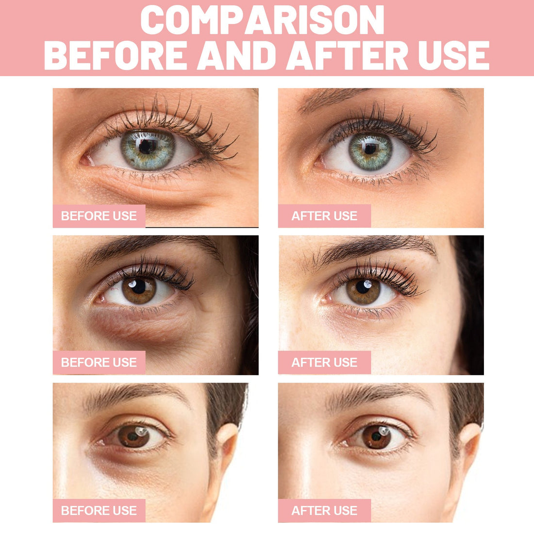 Fading Wrinkle Eye Bag Care